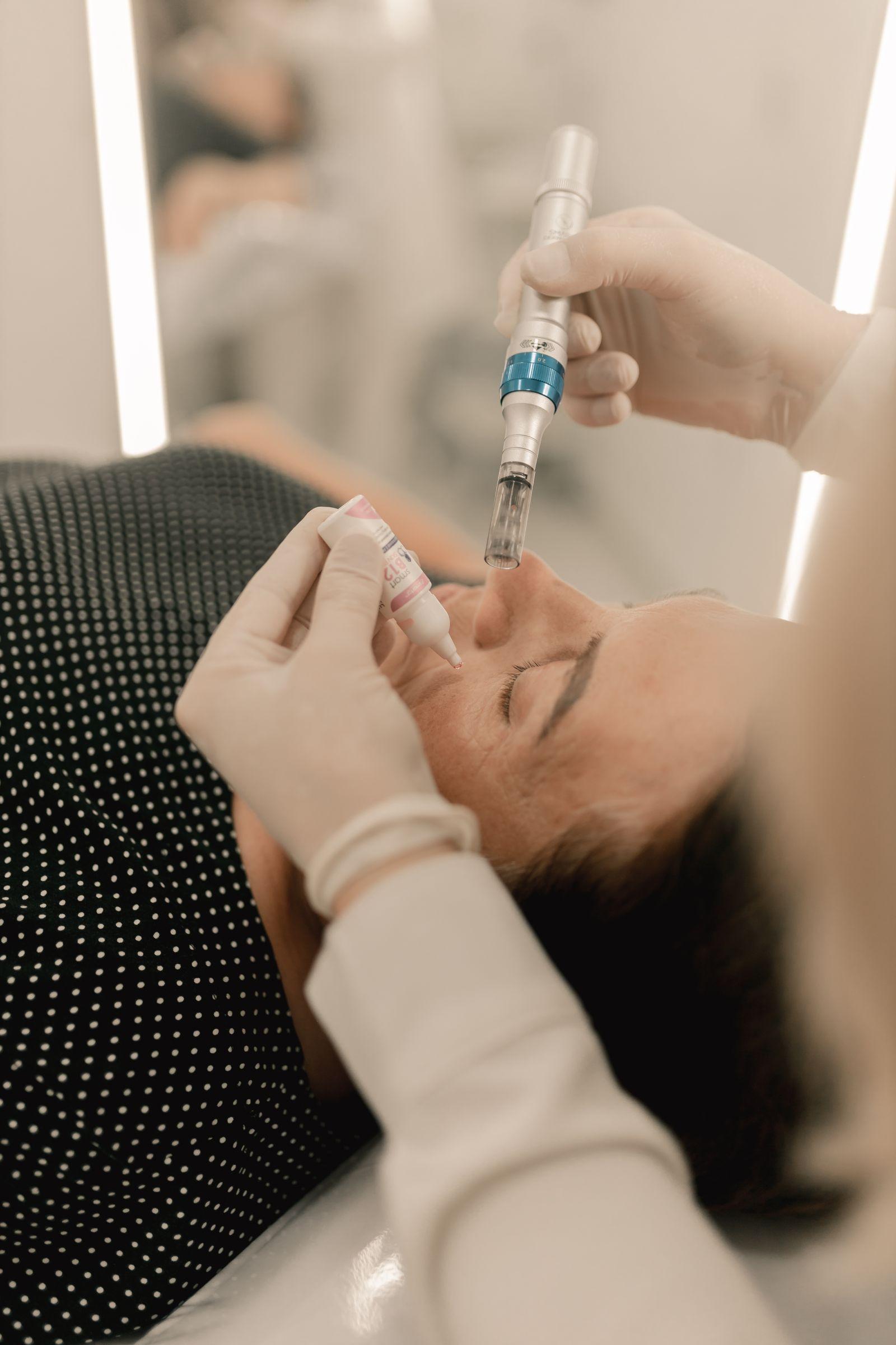 Editorial photograph related to Microneedling. Not a Miss Noora patient result.